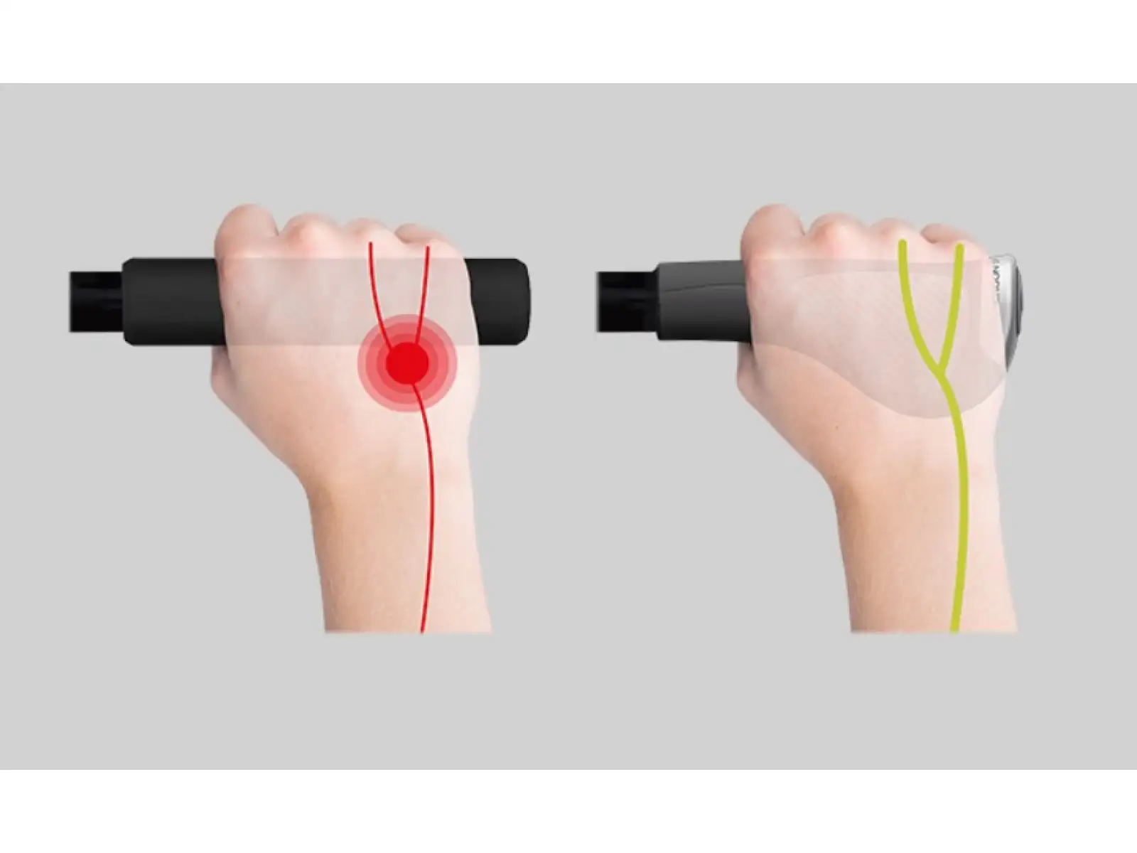 Ergon GP1 Evo grips